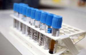 Iki 2018 metų siūloma atidėti Hepatito registro veiklos pradžią