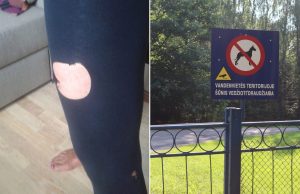 Šuns išpuolis: valdininkas nepamena taisyklių, šeimininkas jų nepaiso