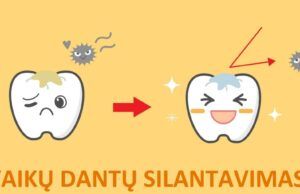 Kviečia pasirūpinti vaikų krūminių dantų silantais