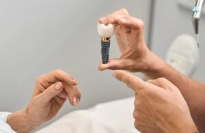 Dantų implantacijos metodas „Maxilla-for-All®“ – kodėl verta rinktis?