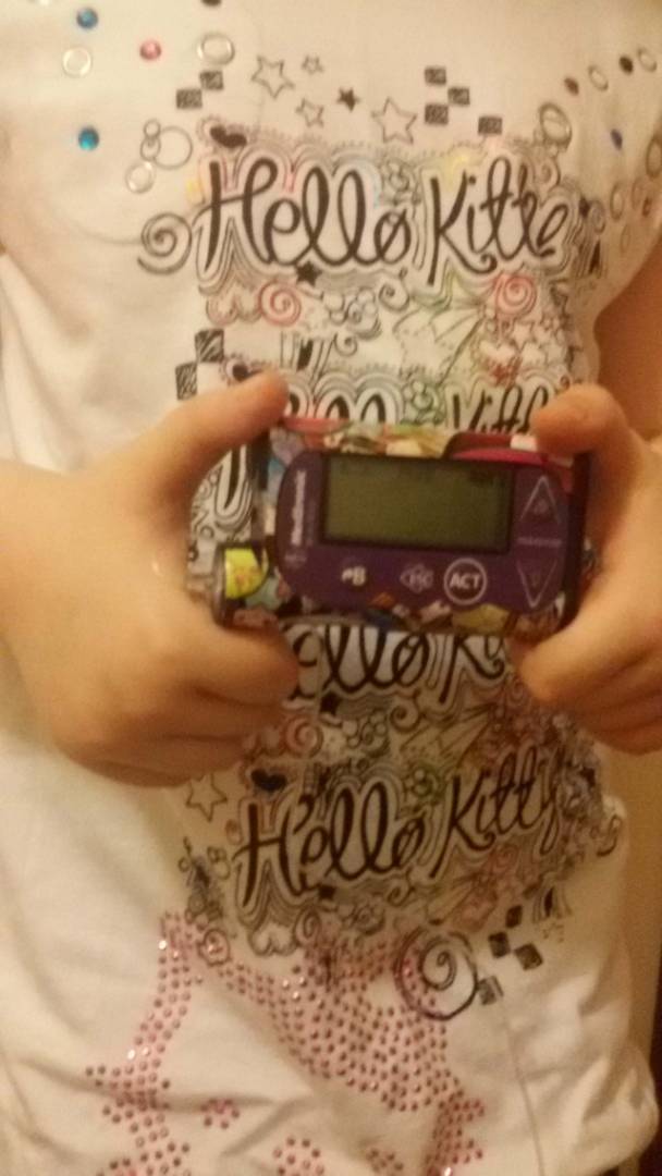 Mažylės rankytėse – insulino pompa. Jai pačiai leista išsirinkti prietaiso spalvą. Smiltė pageidavo violetinės. Asmeninio archyvo nuotr.