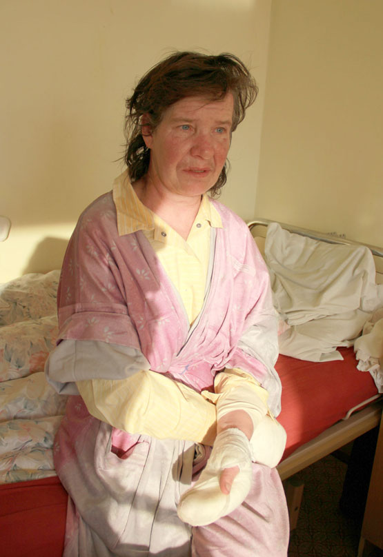 Prie namų sugriuvusi R.Karpova apšalo rankų pirštus. D.Zibolienės nuotr.