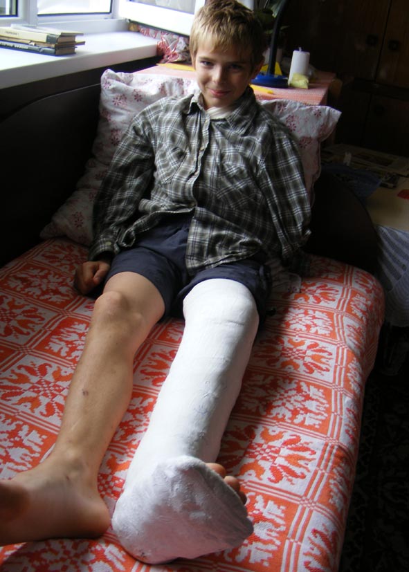 Noras išbandyti mopedą vienuolikmečiui Čivylių kaimo gyventojui Tomui Pranskūnui baigėsi ligonine. A.Mackuvienės nuotr. Noras išbandyti mopedą vienuolikmečiui Čivylių kaimo gyventojui Tomui Pranskūnui baigėsi ligonine. A.Mackuvienės nuotr.