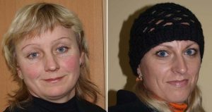 Sporto klubo "Gode" narės (iš kairės) Loreta Skripkienė