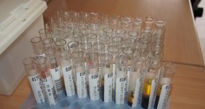 Po tyrimų paaiškės