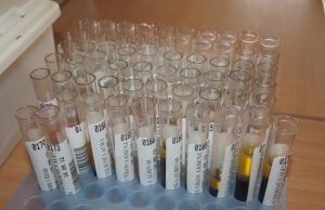 Rokiškėnui įtarta juodligė nepasitvirtino Po tyrimų paaiškės