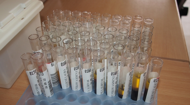 Po tyrimų paaiškės Po tyrimų paaiškės