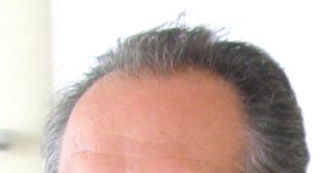 Aloyzas Jočys. D. Zibolienės nuotr.