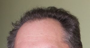 Savivaldybės administracijos direktorius Aloyzas Jočys.