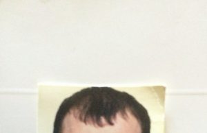 Čečėnų kilmės pabėgėlis parvežtas į Rokiškio ligoninę