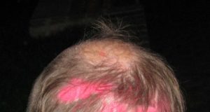 Neįprasta šukuosena. N.Byčkovskio nuotr.