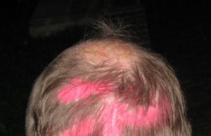 Neįprasta šukuosena. N.Byčkovskio nuotr.