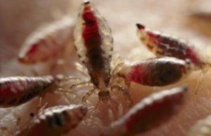 Utėlėtumo problema paaštrėja rudenį. D.Zibolienės nuotr.