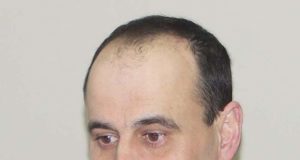 Egidijus VILIMAS