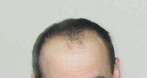 Vicemeras Egidijus Vilimas.